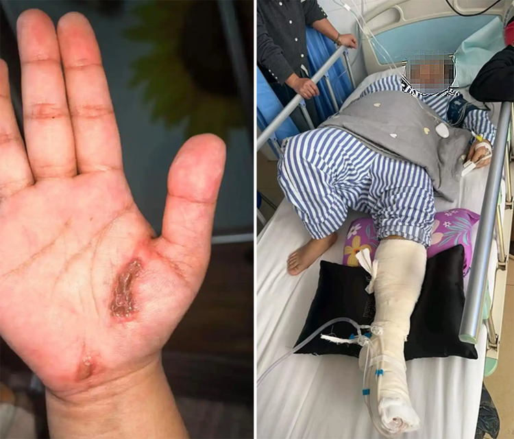 女子边充电边玩手机遭遇电击，被送入ICU抢救，问题出在哪里？